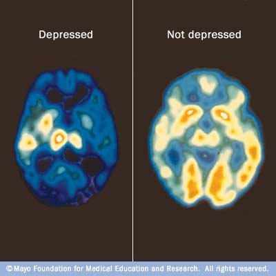 c7_pet_depression.jpg